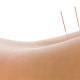 accupuncture naperville