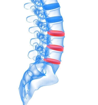 Naperville Chiropractic Care