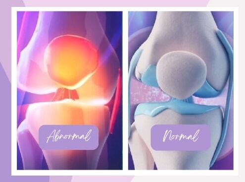 Knee Decompression Near Me