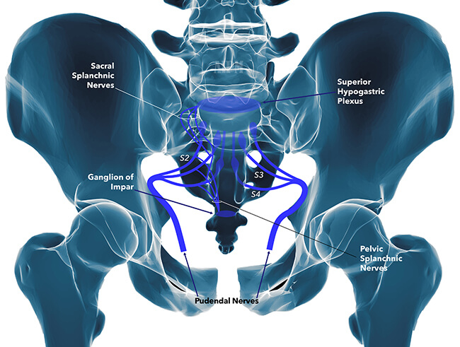 Facet Syndrome Naperville