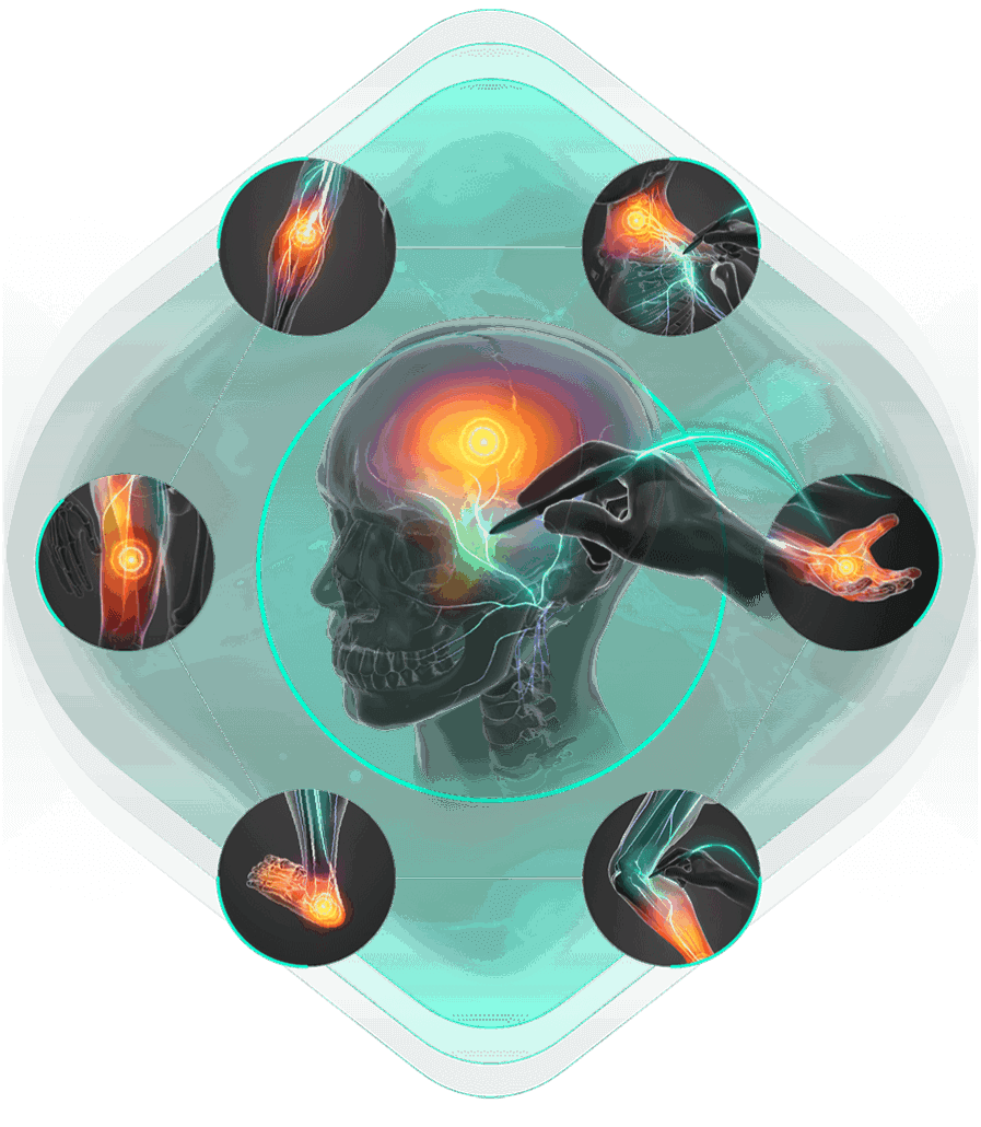 Facet Syndrome Naperville