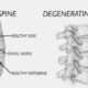 treatments for degenerative disc disease in naperville