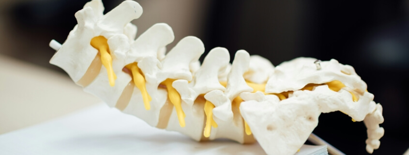 spinal decompression for bulging discs in naperville