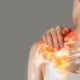 treatments for pinched nerve in naperville il