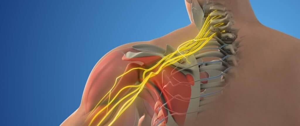 treatments for cervical radiculopathy in naperville cervical decompression for relief from cervical radicullopathy in naperville