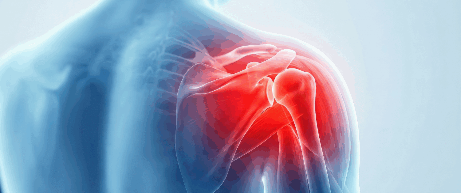 Acupuncture for Shoulder Pain in Naperville IL by Dr Jennifer Wise at Synergy Institute Acupuncture & Chiropractic in Naperville IL 4931 Illinois Rte 59 Suite 121 Naperville IL 60564 (630) 355-8022