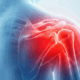 Acupuncture for Shoulder Pain in Naperville IL by Dr Jennifer Wise at Synergy Institute Acupuncture & Chiropractic in Naperville IL 4931 Illinois Rte 59 Suite 121 Naperville IL 60564 (630) 355-8022