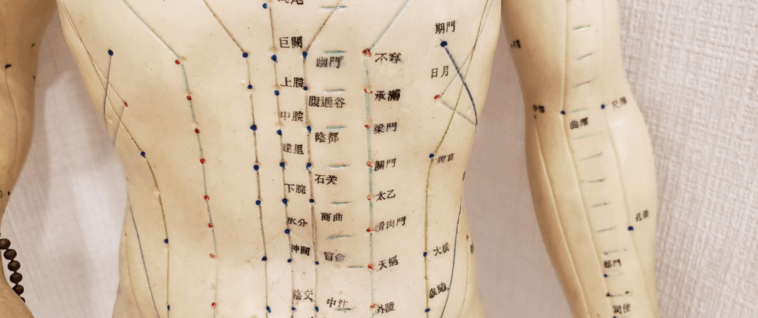 Acupuncture in Naperville IL Acupuncture in Naperville IL by Dr Jennifer Wise at Synergy Institute Acupuncture & Chiropractic in Naperville IL 4931 Illinois Rte 59 Suite 121 Naperville IL 60564 (630) 355-8022