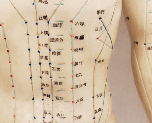 Acupuncture in Naperville IL by Dr Jennifer Wise at Synergy Institute Acupuncture & Chiropractic in Naperville IL 4931 Illinois Rte 59 Suite 121 Naperville IL 60564 (630) 355-8022