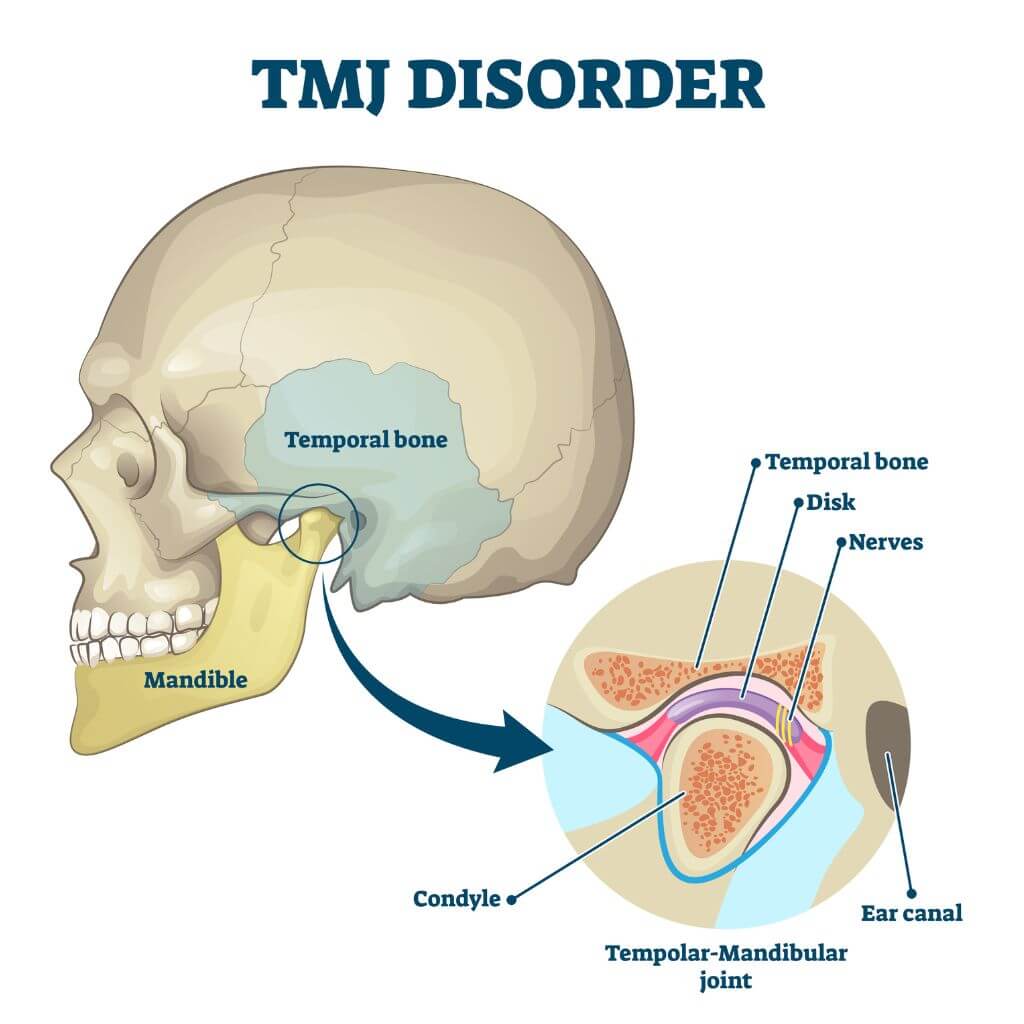 Top TMJ specialist in naperville - best tmp treatments in naperville