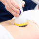 how much does softwave cost in naperville il