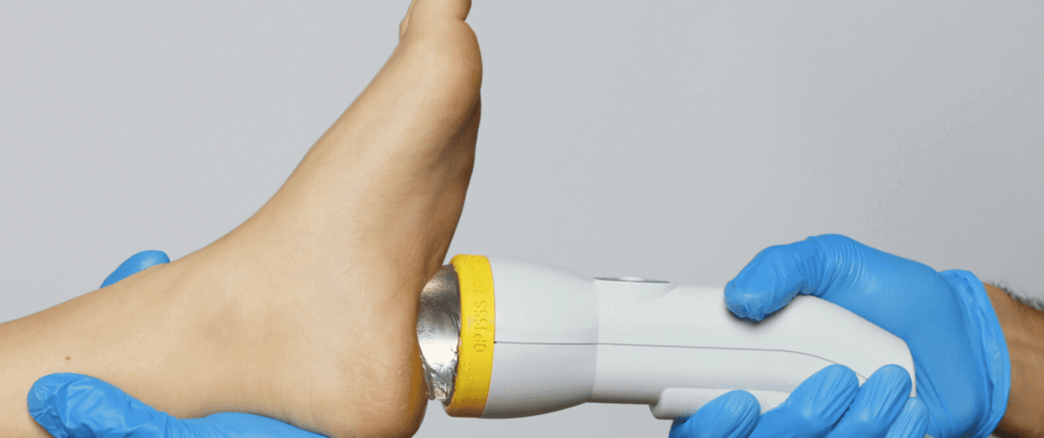 softwave therapy for plantar fasciitis and other foot and heel pain in naperville il