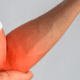 Chiropractic adjustments can help elbow pain - golfers elbow and tennis elbow
