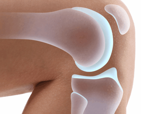 can acupuncture help meniscus injuries in naperville il
