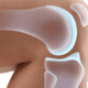 can acupuncture help meniscus injuries in naperville il