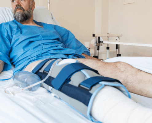 are you considering surgery for a torn meniscus?