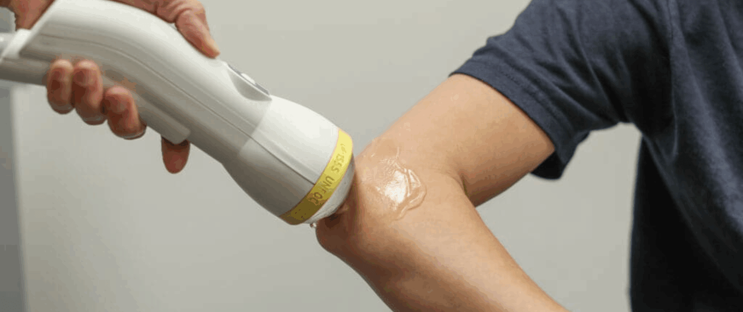 softwave therapy for golfers elbow in naperville il softwave is the best treatemtnds for golfers elbow and other elbow problems in naperville