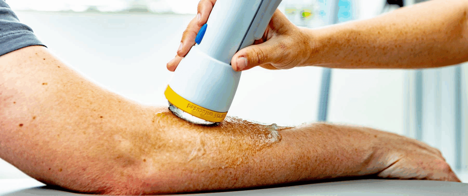 softwave therapy for tennis elbow in naperville il SoftWave Therapy for Tennis Elbow in Naperville IL