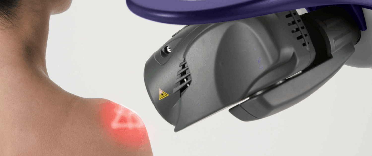 MLS laser can help heal shoulder problems in naperville il