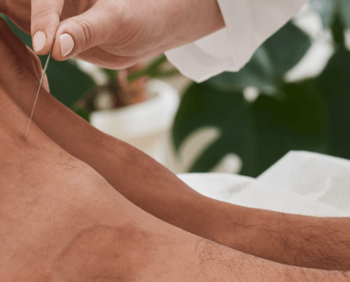 acupuncture for neuropathy p[ain relief in naperville il