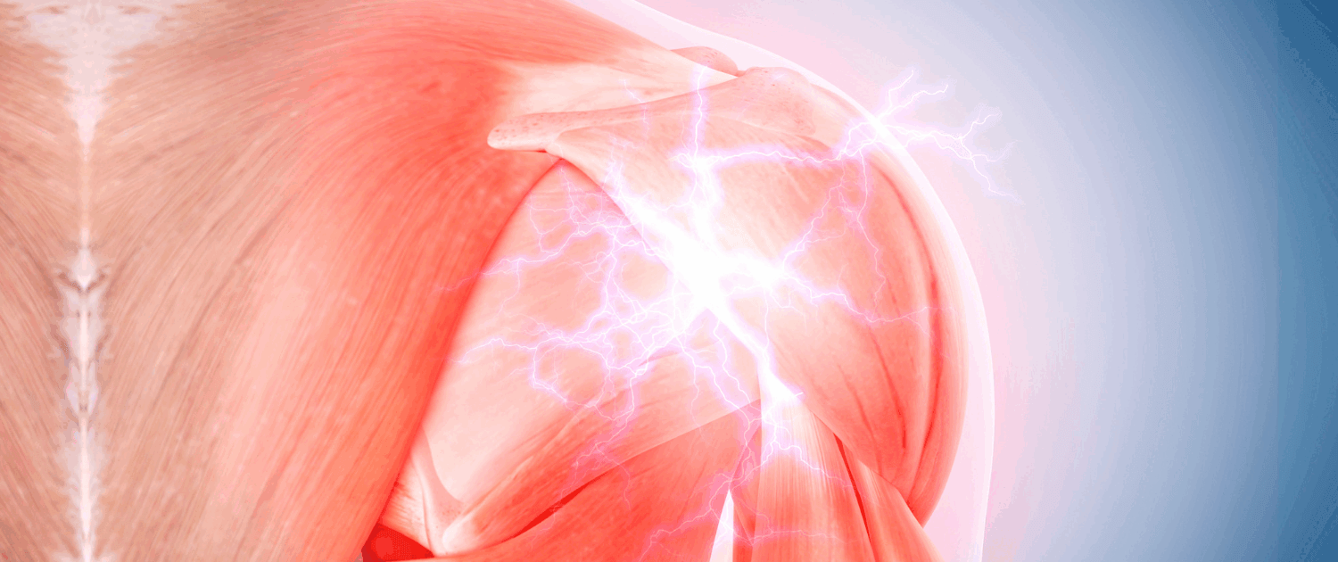 mls laser therapy for frozen shoulder in naperville il Top Naperville Laser clinic helps get relief from Frozen shoulder