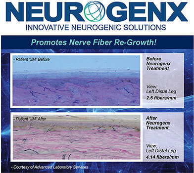 Neurogenx nerve fiber regrowth before and after biopsy comparison showing 65.6% increase in epidermal nerve fiber density confirmed by Advanced Laboratory Services