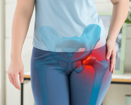 hip Pain Specialist in Naperville il