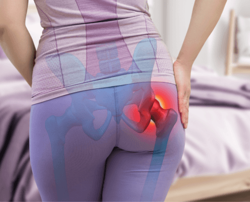 hip Bursitis specialist in naperville il