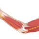 get relief from cubital tunnel syndrome on naperville il