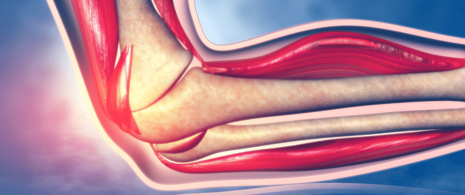 elbow tendonitis treatment in naperville il relief from elbow tendonitis in naperville il