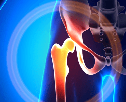 Hip Specialist in Naperville reviews hip pin vs Si joint pain