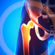 Hip Specialist in Naperville reviews hip pin vs Si joint pain