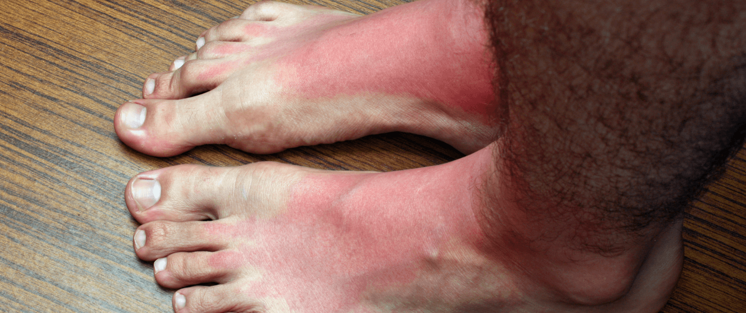 burning and tingling feet in naperville il get relief from burning and tingling feet at naperville neuropathy clinic